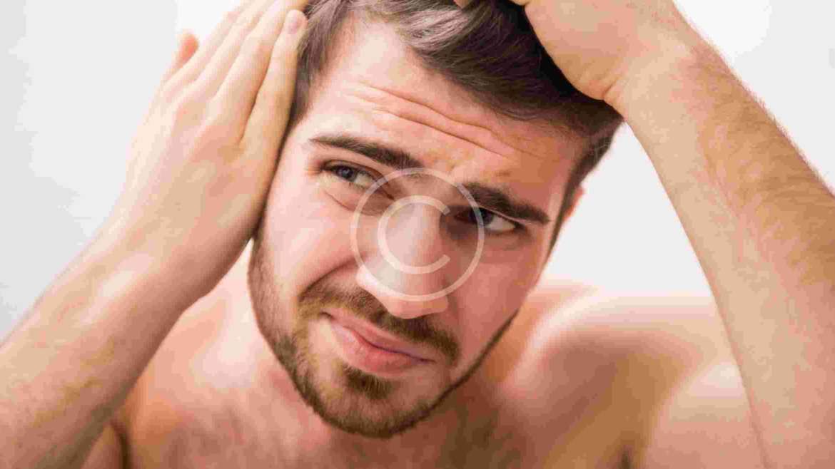 Going Bald Too Young? Top Tips From The Experts!